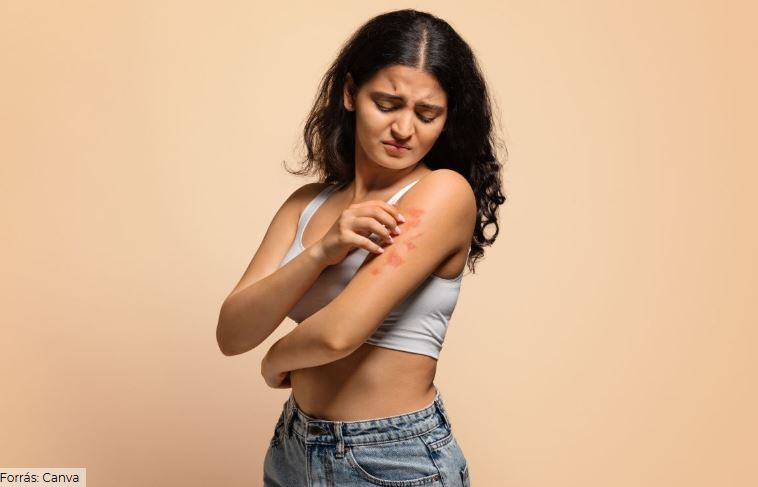 Alattomos bél- és bőrgyulladások Beauty Kiállítás